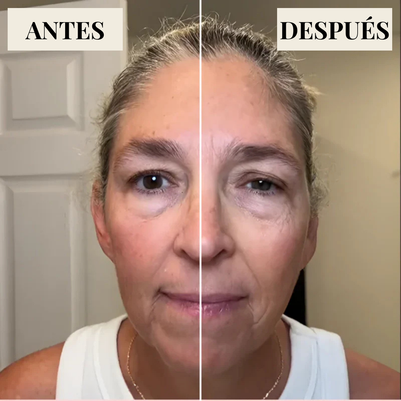 Reduce la hinchazón facial con  el Cepillo Lynfatic Sculpt Brush™